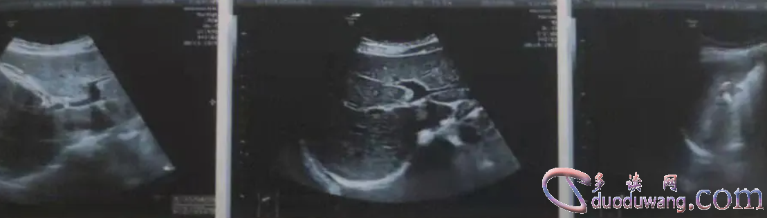 1716814991777729.png image.png