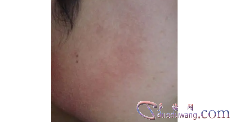 1717252916749050.png image.png