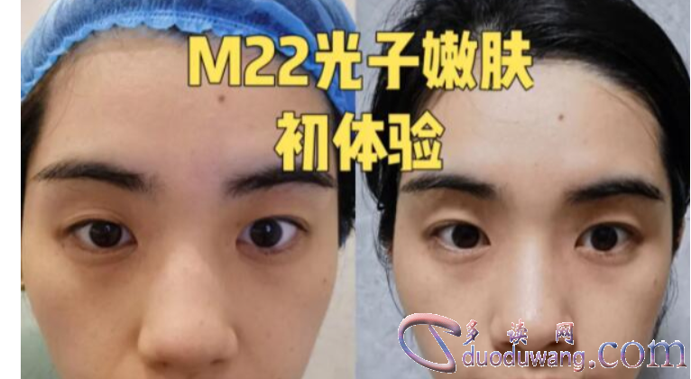 1717253121155703.png image.png