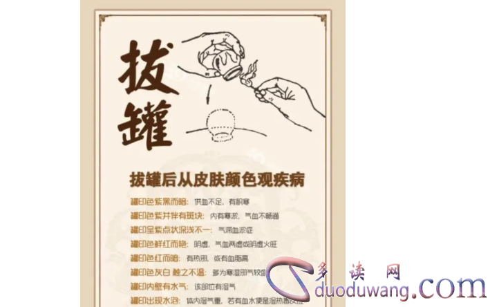 1717299658332925.png image.png