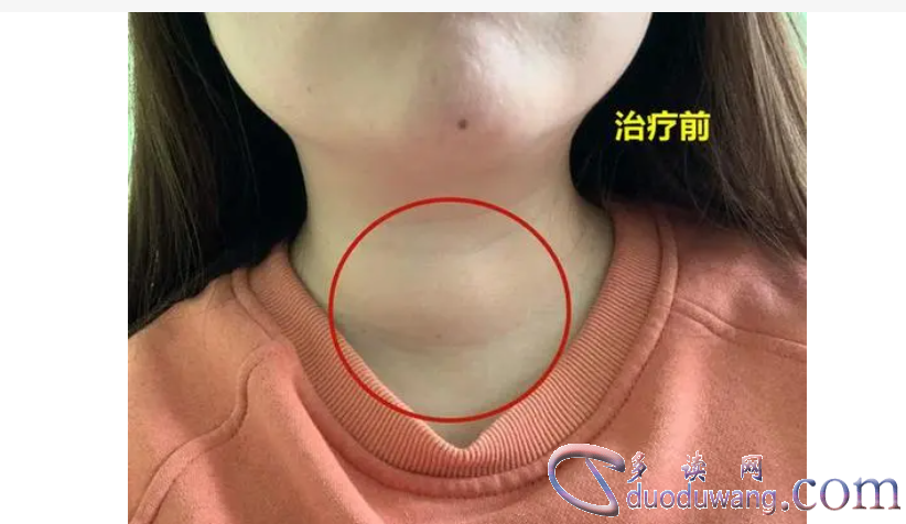 1717416225528106.png image.png