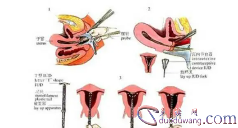 1717597738506016.png image.png